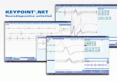Keypoint.Net Software: Eine flexible und intuitive Software, die auf bald 50 Jahre Erfahrung in der Neurophysiologie aufbaut. Lesen Sie einige ihrer Vorzüge.