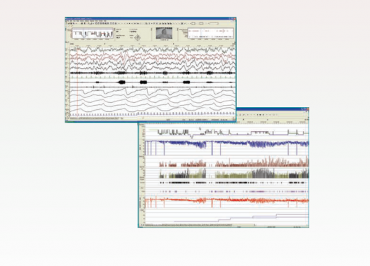 Embla® RemLogic™: The world’s most widely accepted sleep diagnostic. Diagnose Obstructive Sleep Apnea Syndrome (OSAS) and other sleep disorders (differentiate central and obstructive apneas, hypopnea, cardiac-, neurologic- and respiratory-related sleep disorders, optimize your PAP (Positive-Airway-Pressure) therapy…).