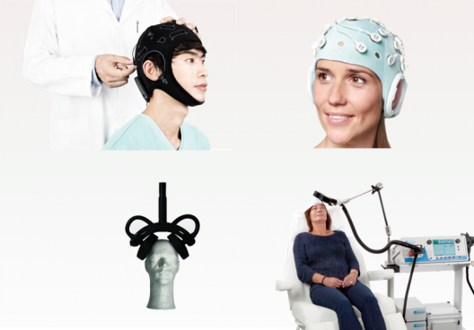 Nicht-invasive Hirnstimulation (NIBS)