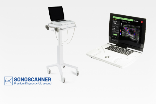 Ondina tragbares Ultraschallgerät für den Einsatz am Patientenbett, im Notfall, in der Praxis, Allgemeinmedizin, Radiologie, Gynäkologie, Weichteile, MSK (Orthopädie, Neurologie, Rheumatologie), Anästhesie, Urologie, Gefässdiagnostik, Abdomen, Pädiatrie...